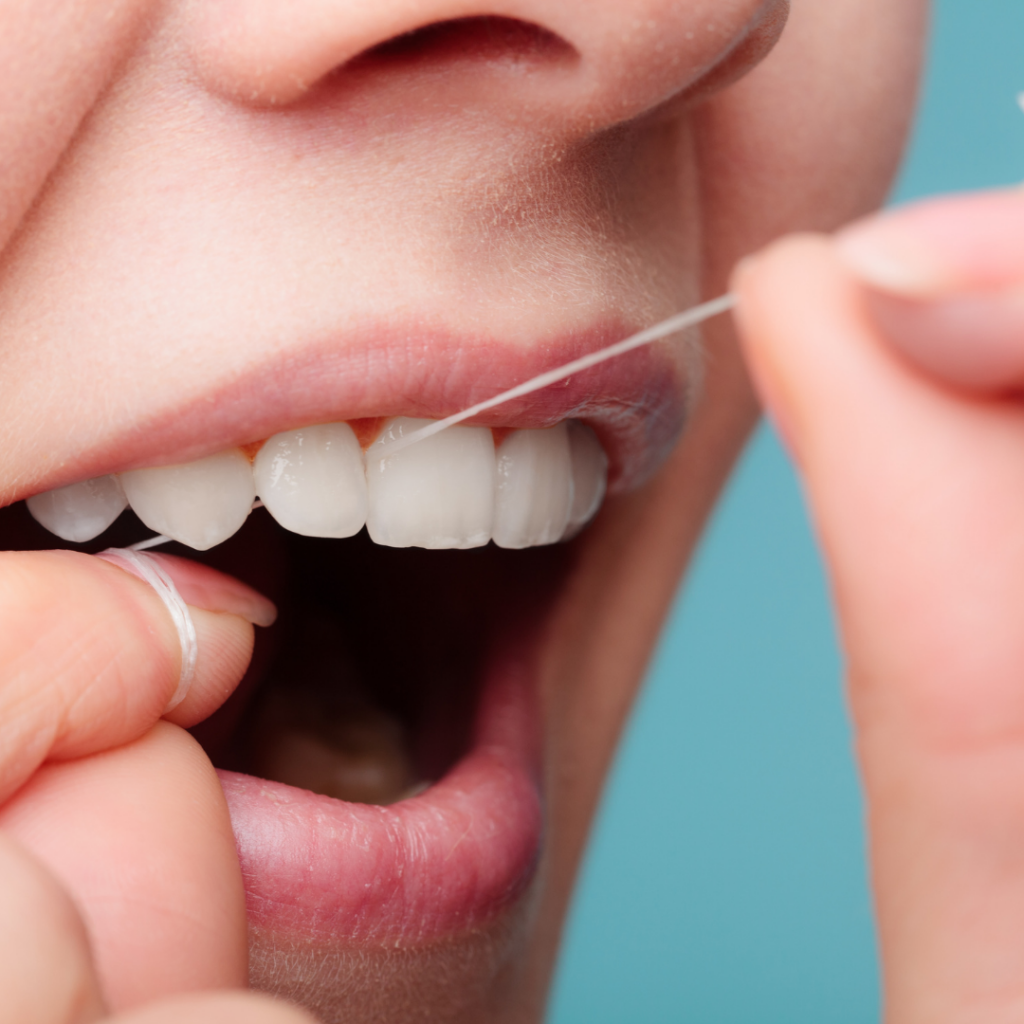 cara mencegah karang gigi