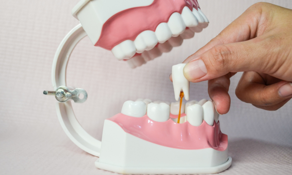 Masalah Gigi yang Sering Terjadi pada Anak-anak