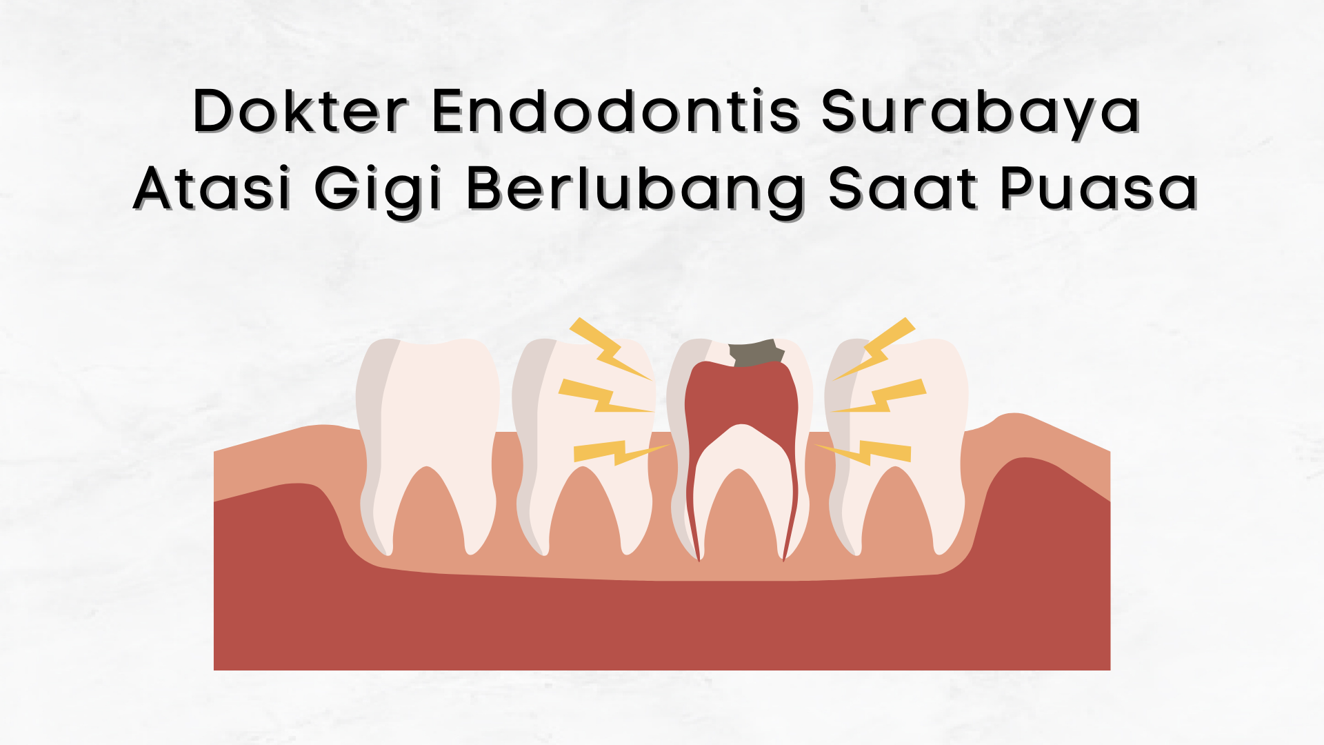 Dokter Endodontis Surabaya: Atasi Gigi Berlubang Saat Puasa