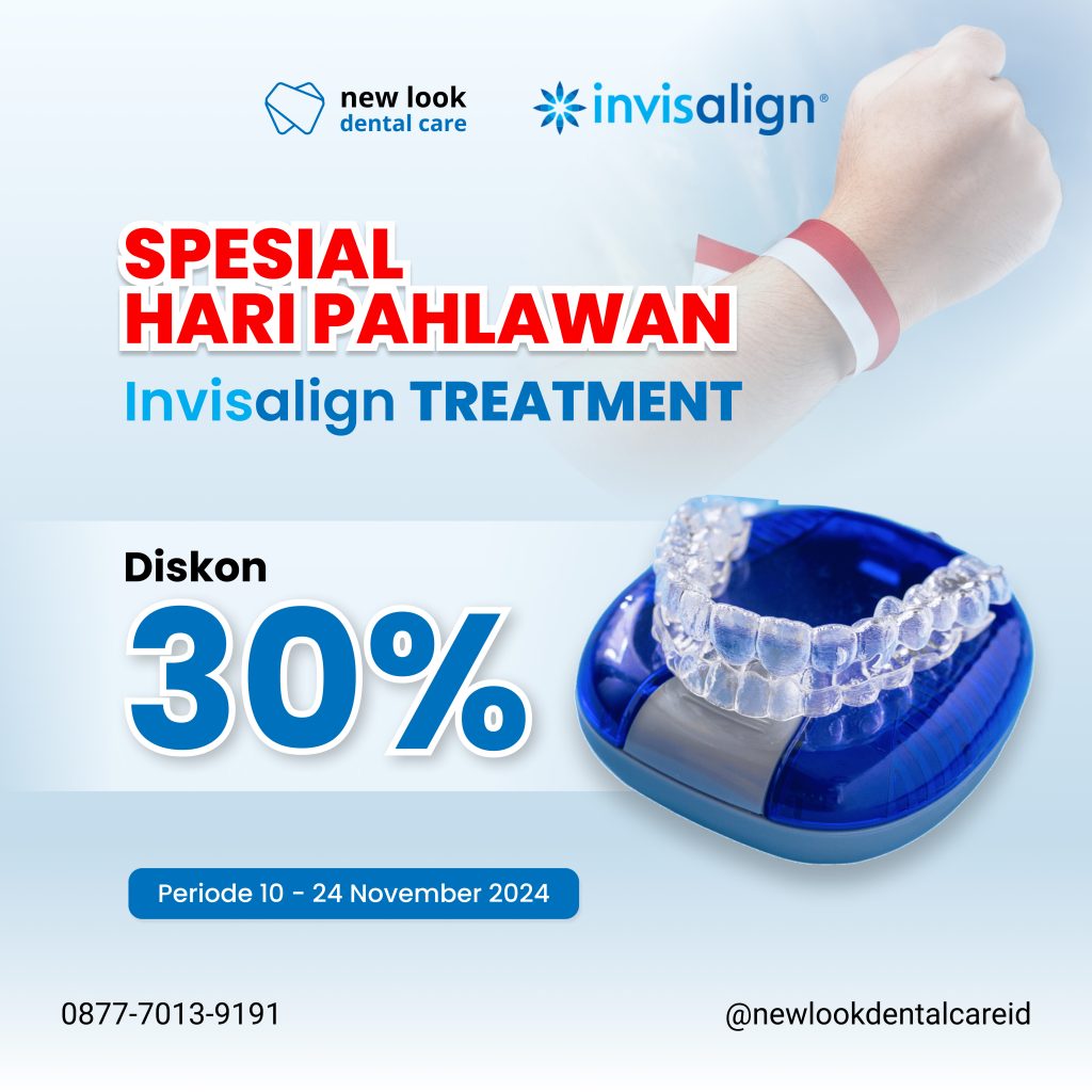 Dokter Gigi Spesialis Surabaya - Pentingnya Tracking Invisalign