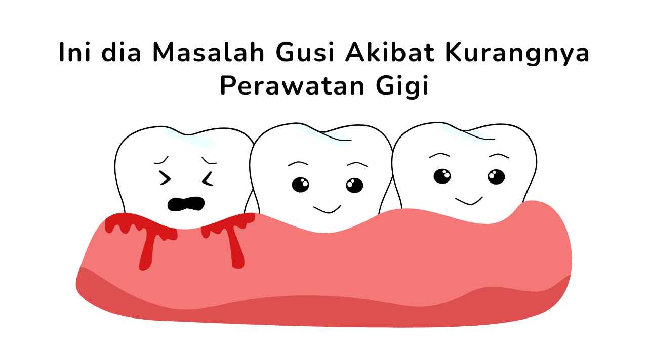Ini dia Masalah Gusi Akibat Kurangnya Perawatan Gigi