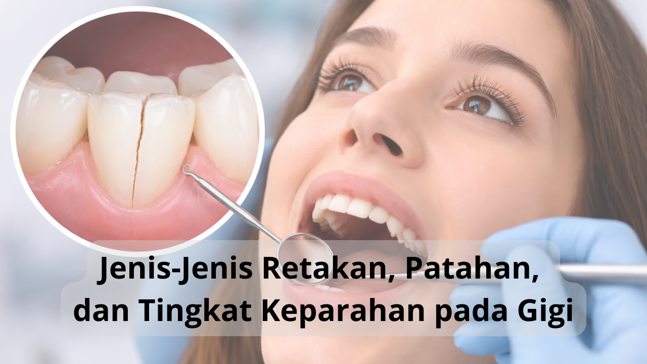 Jenis-Jenis Retakan, Patahan, dan Tingkat Keparahan pada Gigi