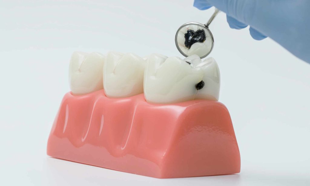 Dokter Gigi Spesialis vs Dokter Gigi Umum, Cek Penjelasannya!