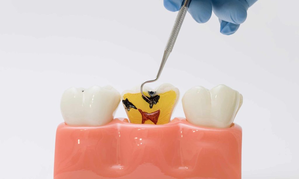 Dokter Gigi Spesialis vs Dokter Gigi Umum, Cek Penjelasannya!