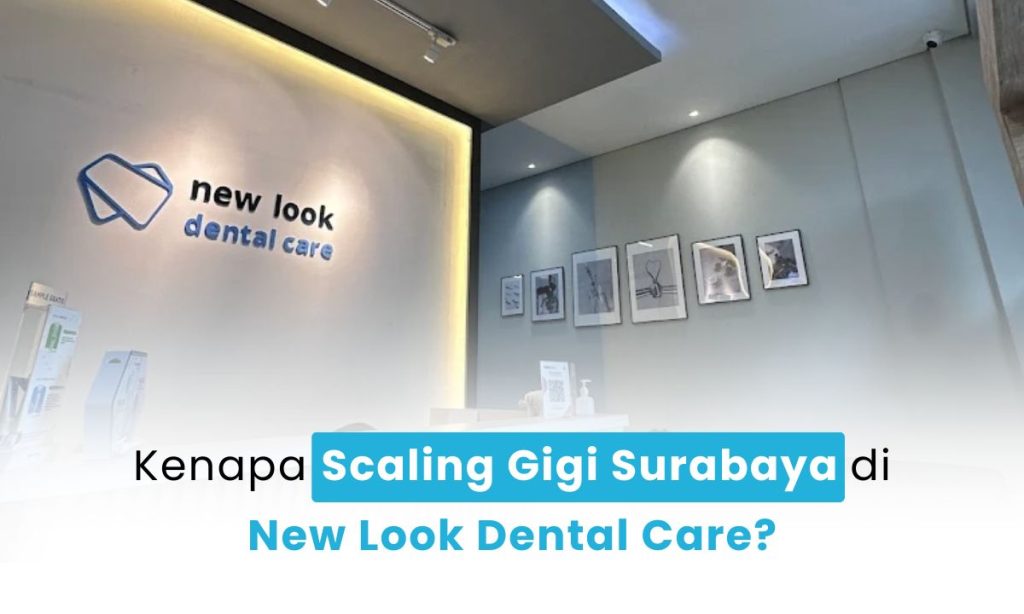 Scaling Gigi Surabaya: Cara Efektif Membersihkan Karang Gigi