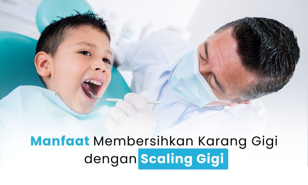 Scaling Gigi Surabaya: Cara Efektif Membersihkan Karang Gigi