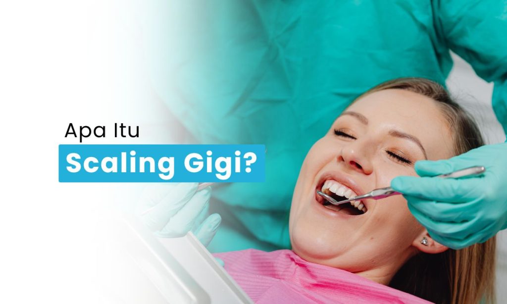 Scaling Gigi Surabaya: Cara Efektif Membersihkan Karang Gigi