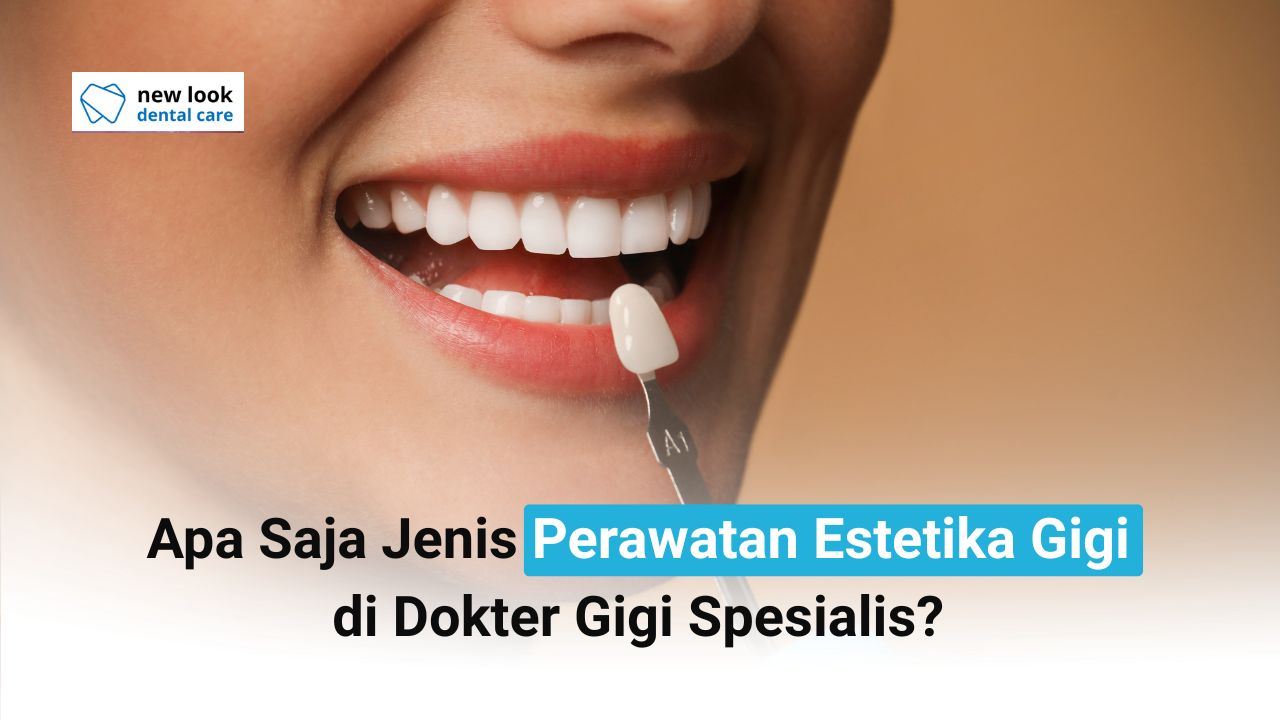 Apa Saja Jenis Perawatan Estetika Gigi di Dokter Gigi Spesialis